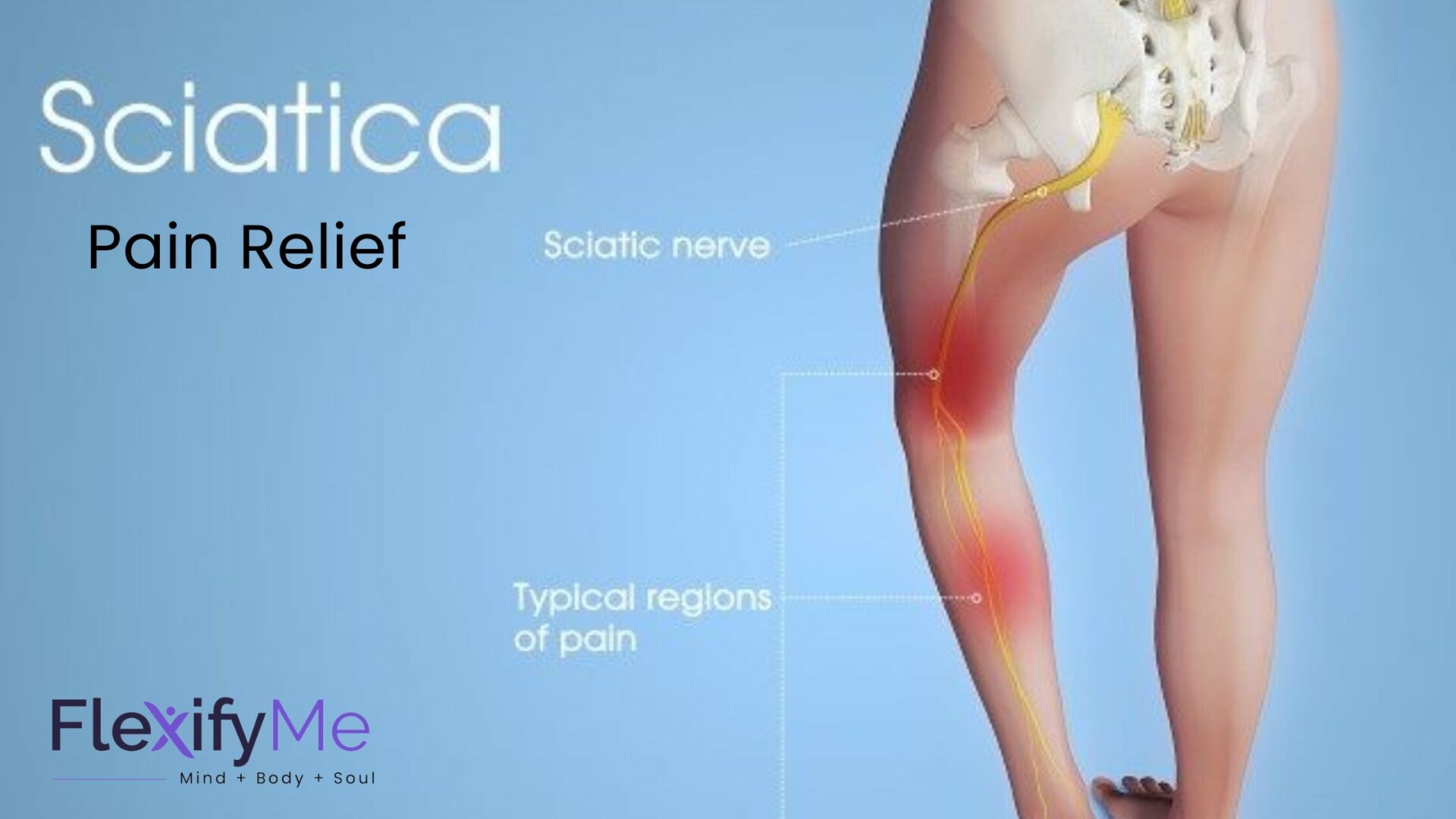 sciatica Pain Relief