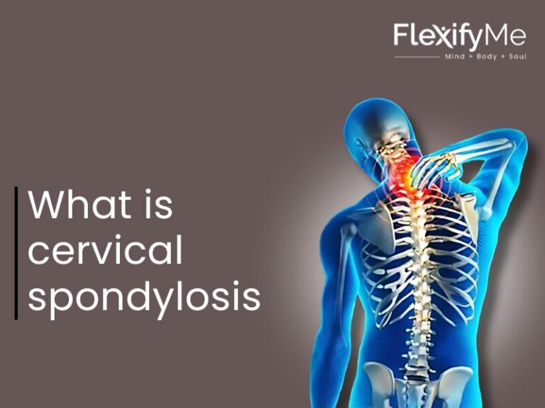 Cervical Spondylosis Treatment with Yoga & Physiotherapy