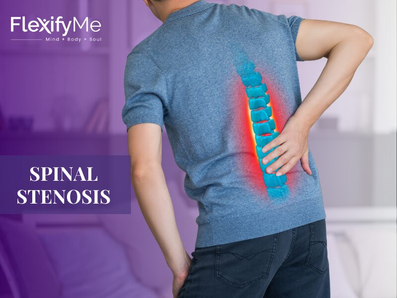 Spinal Stenosis: Causes, Symptoms, Treatment & Excercises