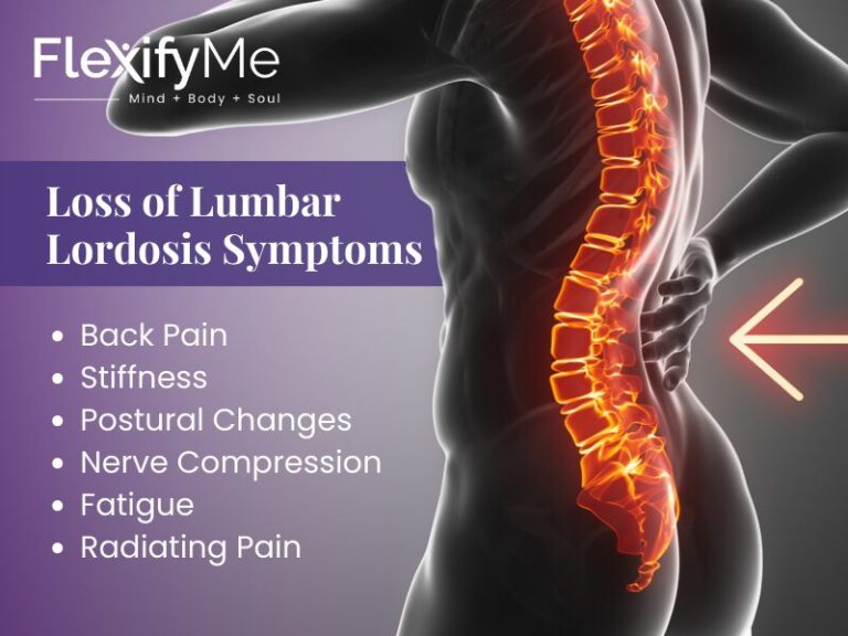 Loss Of Lumbar Lordosis Causes Symptoms And Treatment